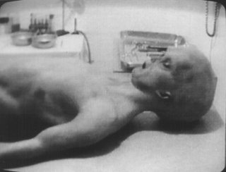 Photo of Torso From Alien Autopsy