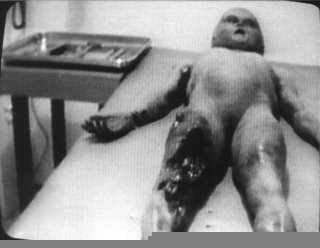 Photo of Torso from 'Alien Autopsy' film