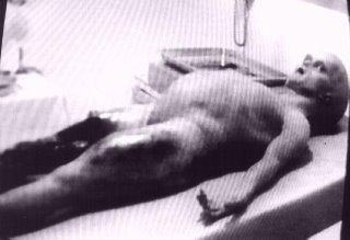 Alien Autopsy Full Body